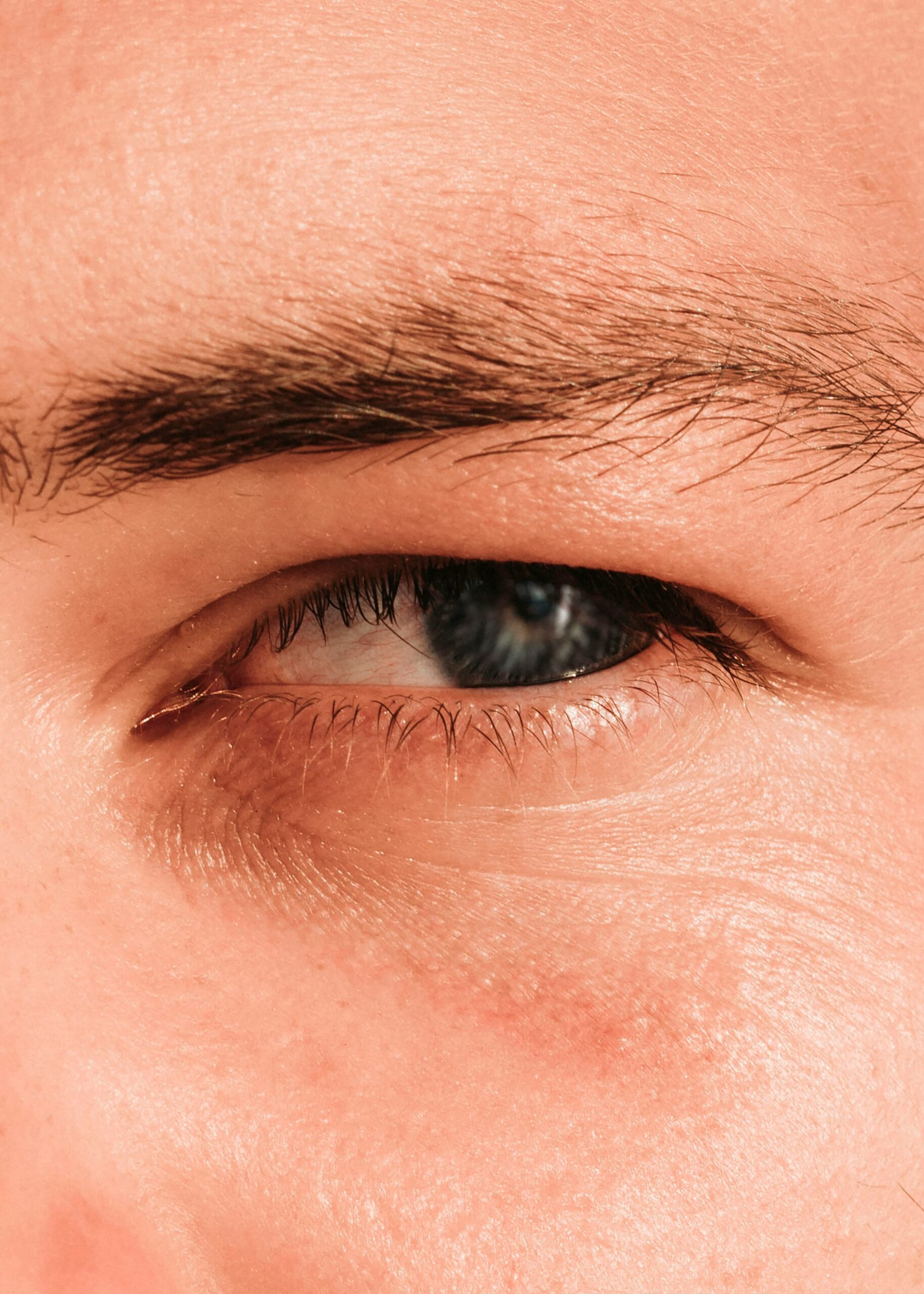 Bovenste Ooglidcorrectie : antwoord op de meest gestelde vragen